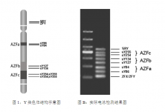 1-14110120000U94.png